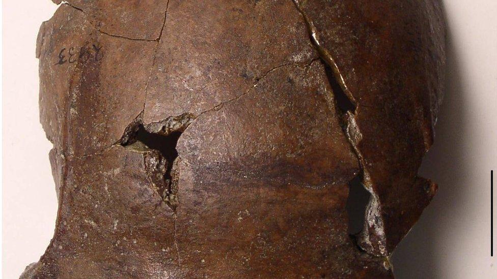 The skull found in Aitape, Papua New Guinea