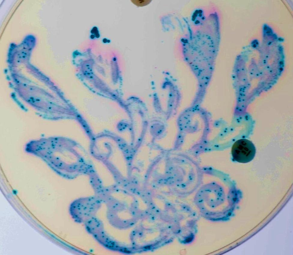 Oxford University scientist makes art from the gut - BBC News