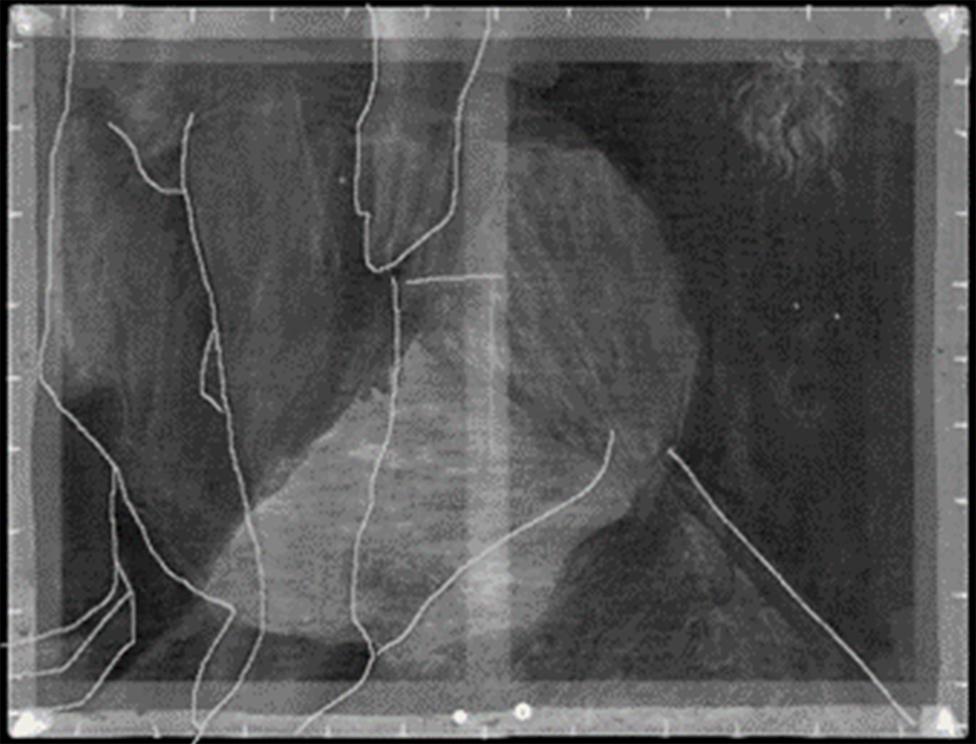 X-ray of La Pose Enchantée by Rene Magritte