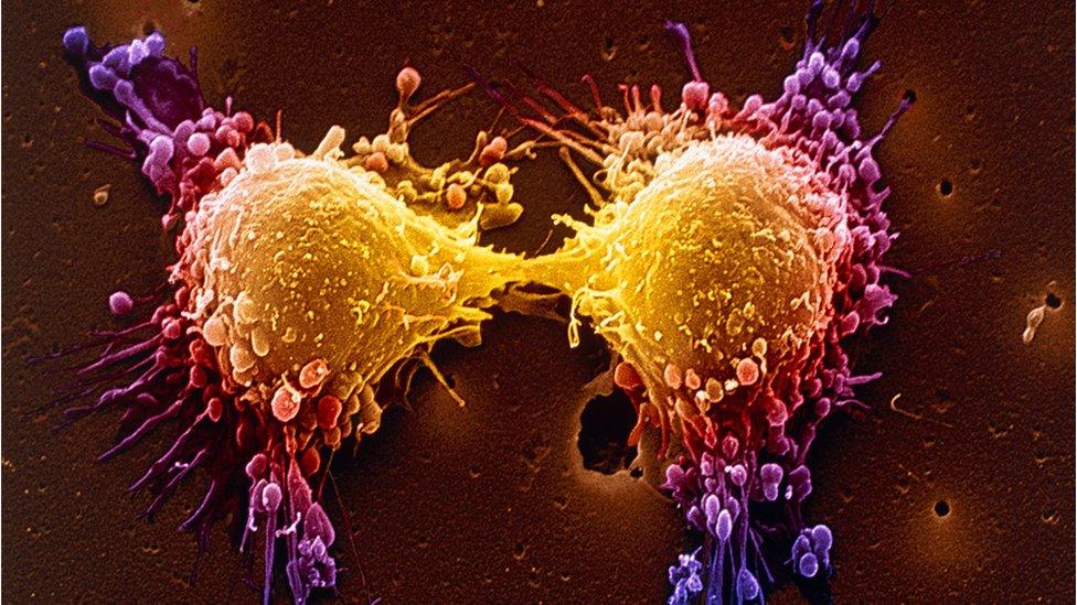 Prostate cancer cells