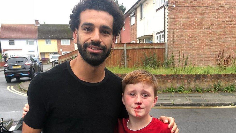 Mohamed Salah and Louis with a bloodied nose