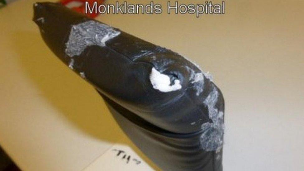 Damage to a patient positioning piece at Monklands Hospital