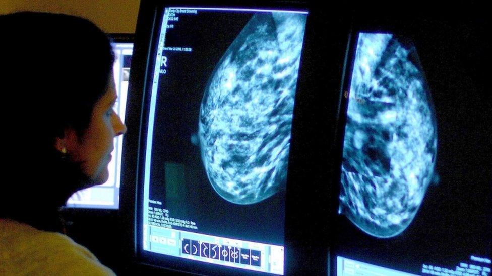 File photo of a consultant analysing a mammogram