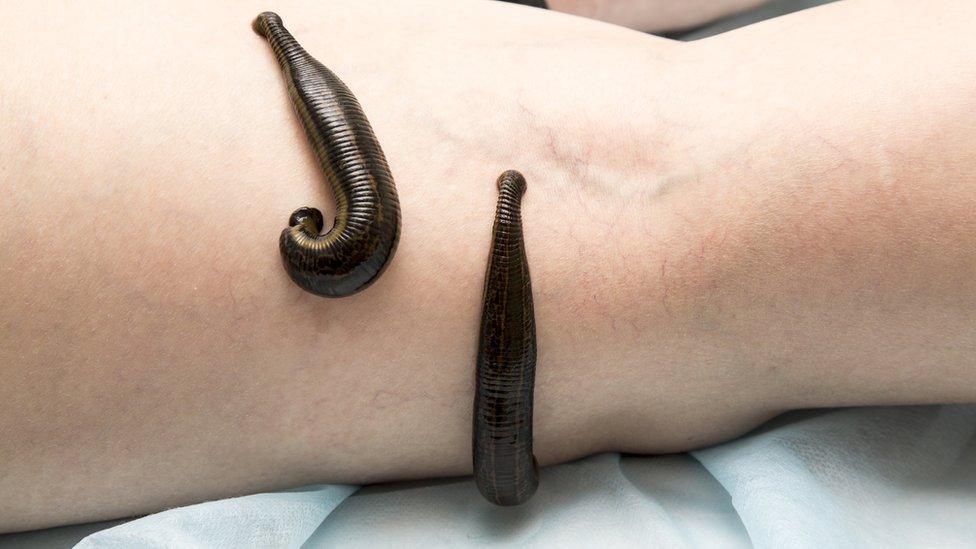 Two leeches on a bare arm