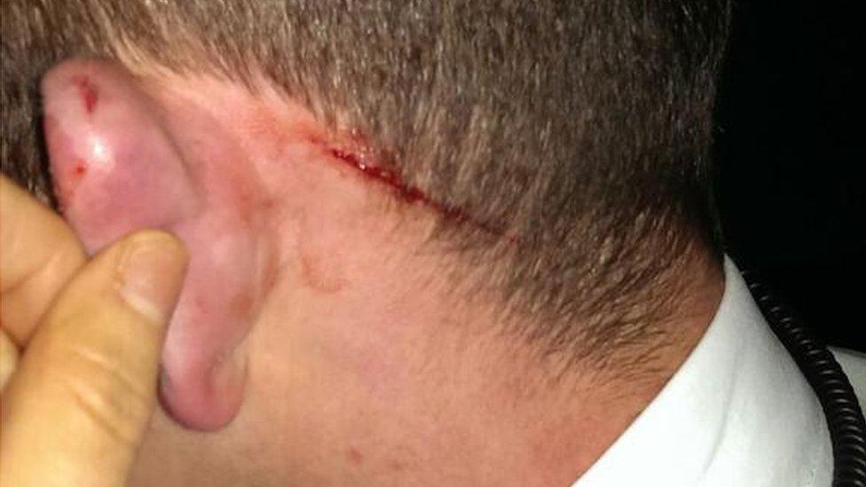 One PSNI officer sustained cuts to his head in an assault