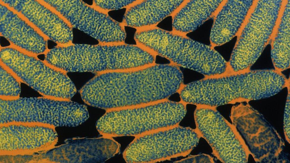 False-colour transmission electron micrograph of a colony of the Gram-negative bacteria Legionella pneumophila, cause of Legionnaires' disease.