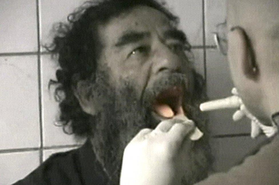 Saddam Hussein being examined after capture