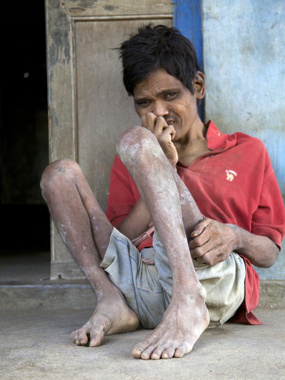 Campret sitting on the ground