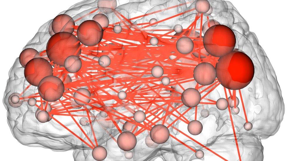 illustration of brain connection map