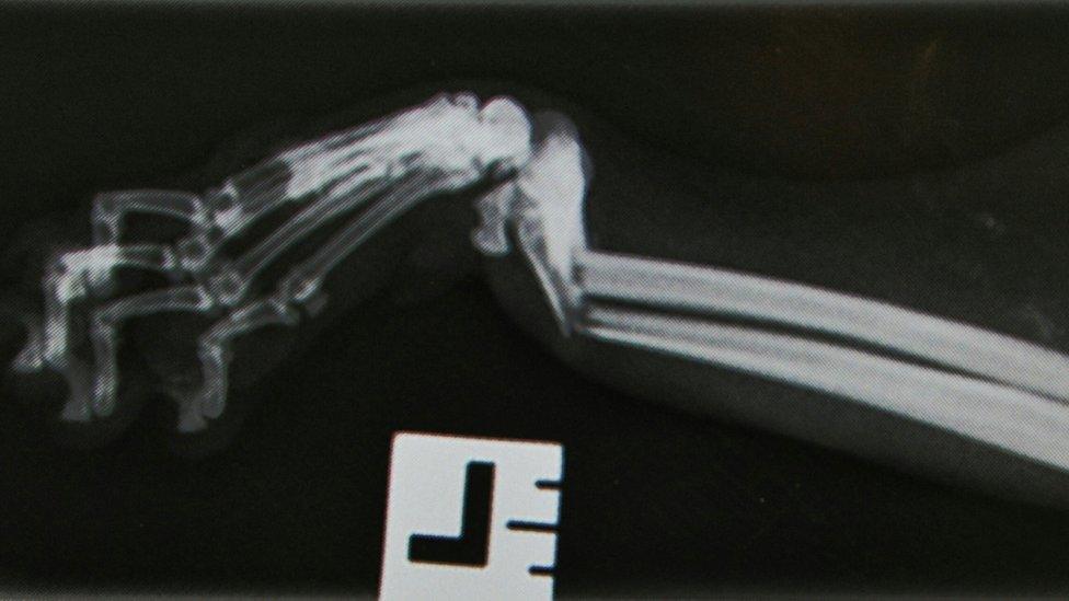 Shinji Hancock's x-ray