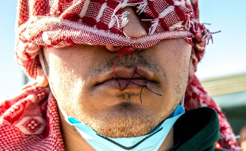 Iranian protester at Calais migrant camp (March 2016)