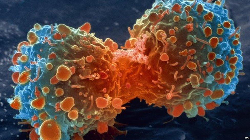 Lung cancer cells