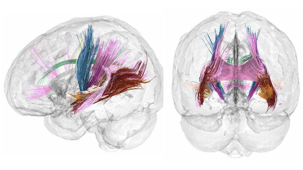 Major tracts of white matter in the brain show evidence of increasing during pregnancy