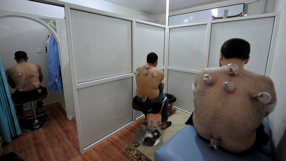 Wet cupping in Benghazi