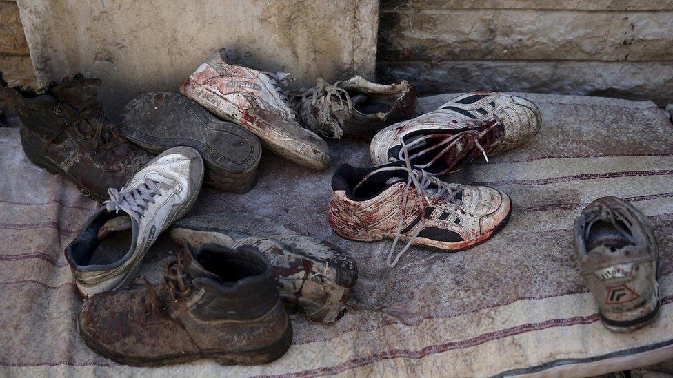 Blood stained shoes are pictured after Syrian government forces fired missiles on a busy marketplace in the Douma neighbourhood of Damascus, Syria October 30, 2015.