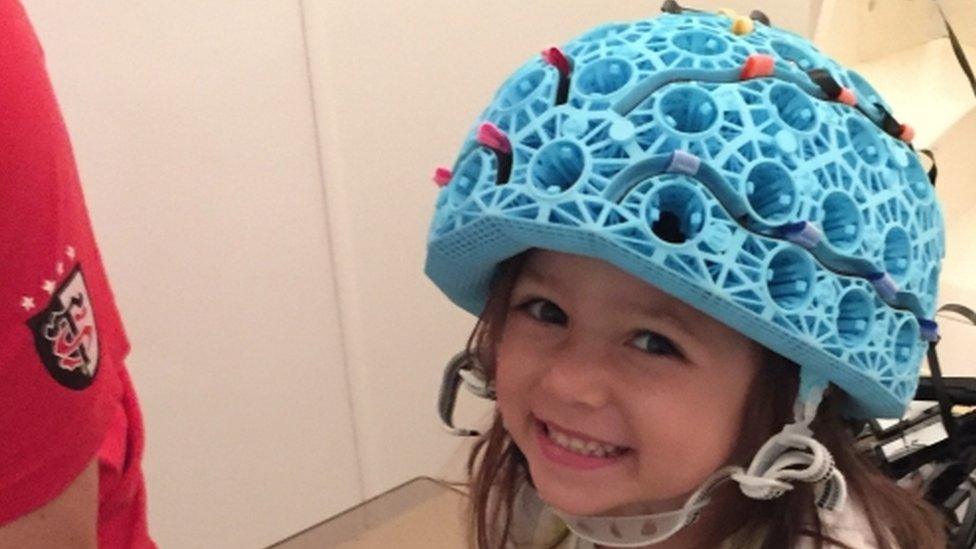 Child in new helmet style brain scanner to diagnose epilepsy