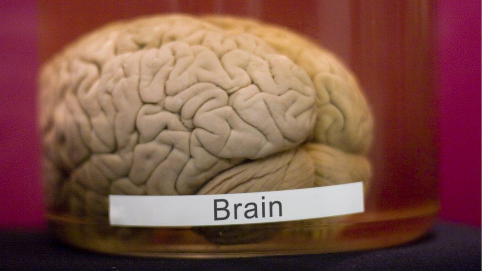 A brain