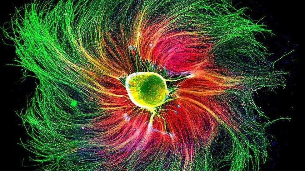 A sensory neuron from an embryonic rat