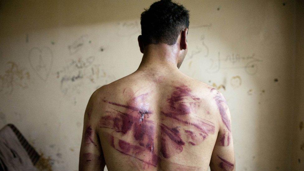 File photo of a Syrian man showing marks of torture on his back (23 August 2012)