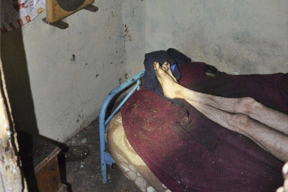 The legs of a man, 59, in a three-square-meter dovecot in Dos Hermanas, Seville, Spain, 29 December 2015.