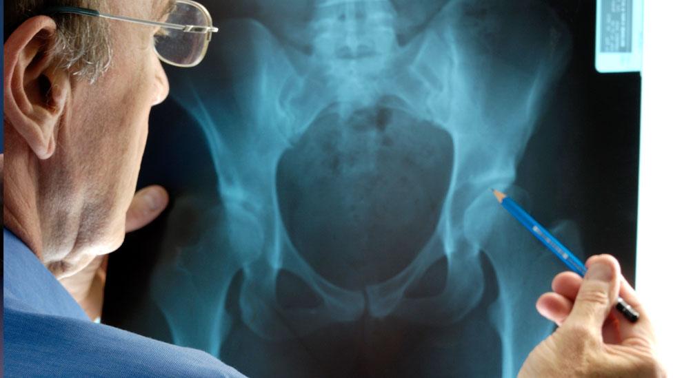 Doctor examining x-ray