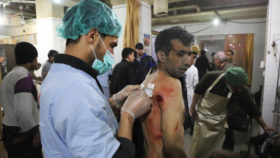 A wounded Syrian man receives treatment as victims of reported regime air strikes on Hamouria, Saqba and Kafr Batna