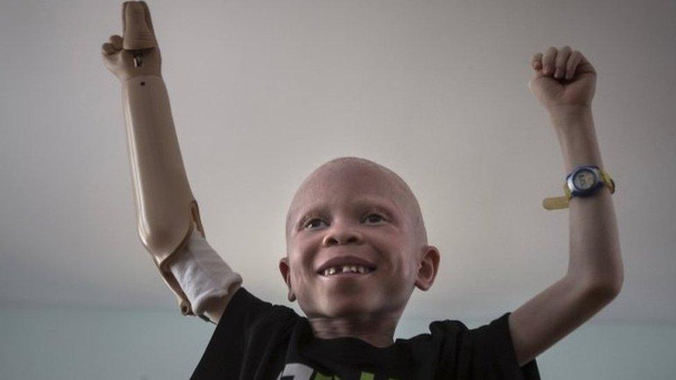 5-year-old Baraka Cosmas from Tanzania dances along as a video plays on a computer in the Staten Island borough of New York, September 21, 2015.