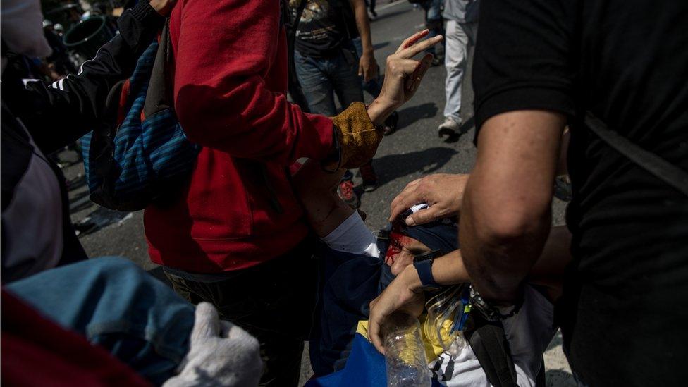 An injured protester is helped up from the ground