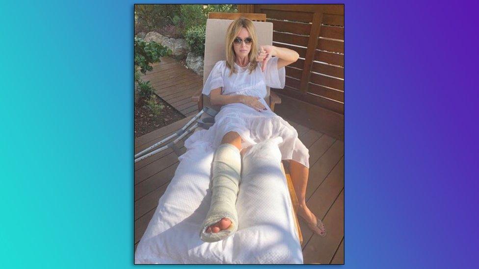 amanda-holden-broken-leg.