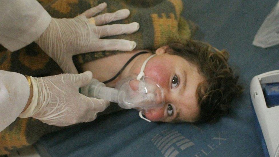 A child with an oxygen mask looks at the camera