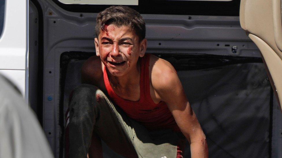 A wounded boy cries in an ambulance following a reported airstrike in Kafar Roma in the outskirts of Maaret al-Numan in the southern Idlib province on July 25, 2019