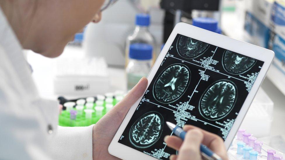 researcher looking at images of the brain