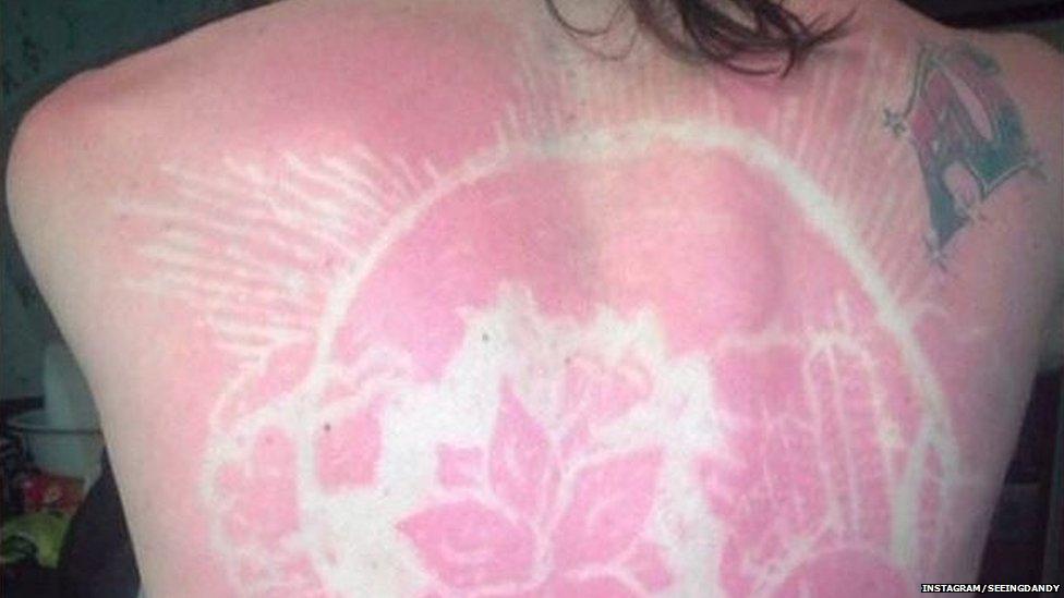 Sunburn art is a thing now BBC News