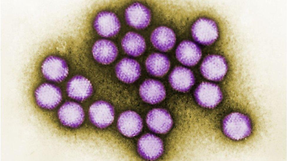 Colourised TEM (transmission electron microscopic) image of adenovirus