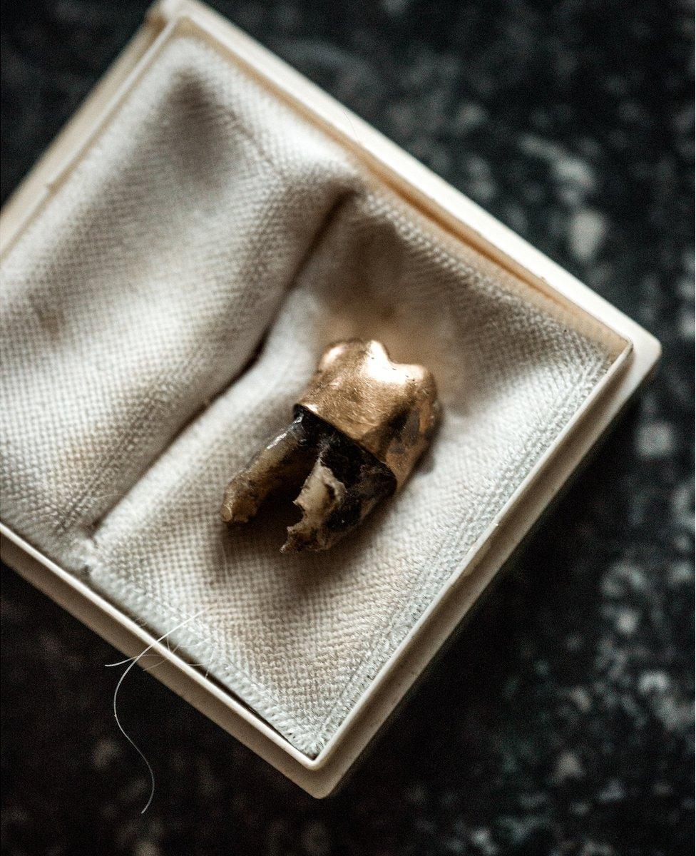 Picture of a tooth in a display box