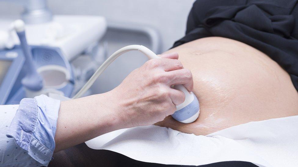 A woman receives an ultrasound