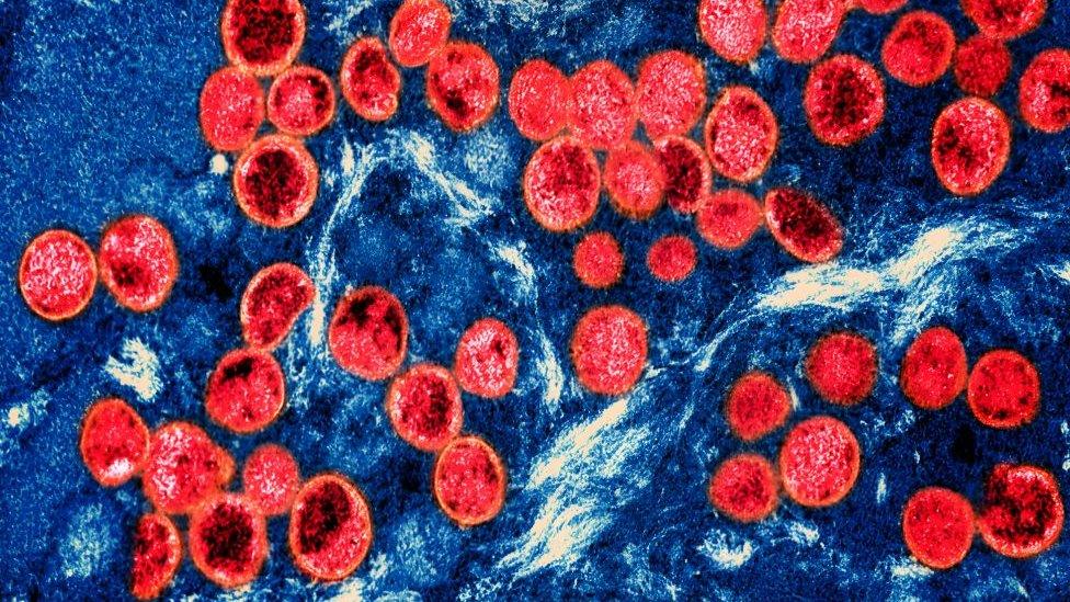 Colorized transmission electron micrograph of monkeypox virus particles (red) found within an infected cell (blue), cultured in the laboratory.