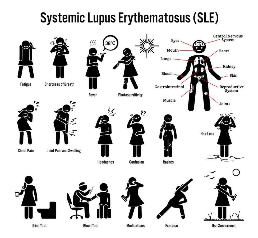 Lupus graphic