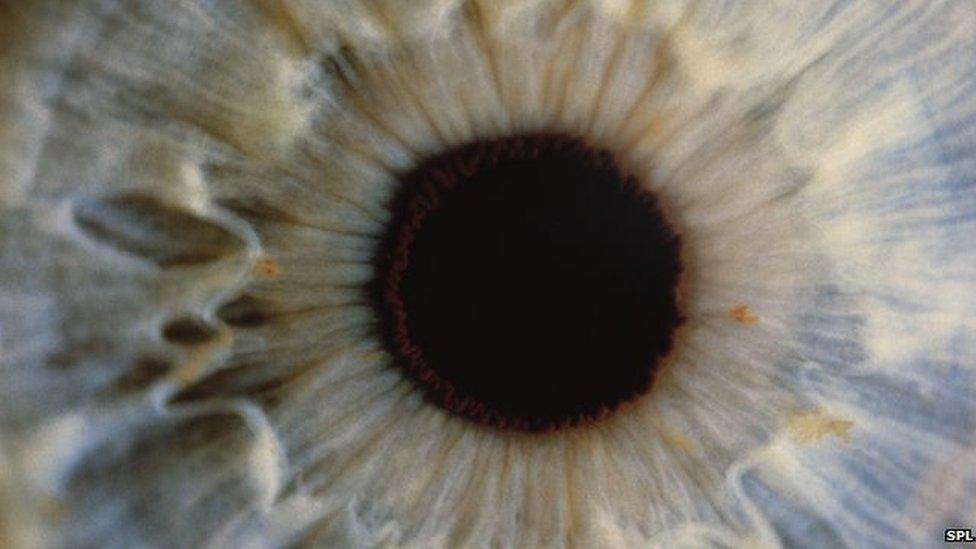 Eye stock photo - viruses can cause inflammation in the eye