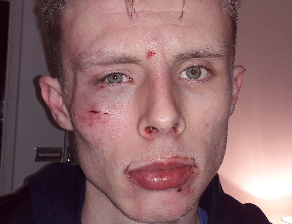 Ben Law was left with facial injuries after being attacked by an off duty prison guard