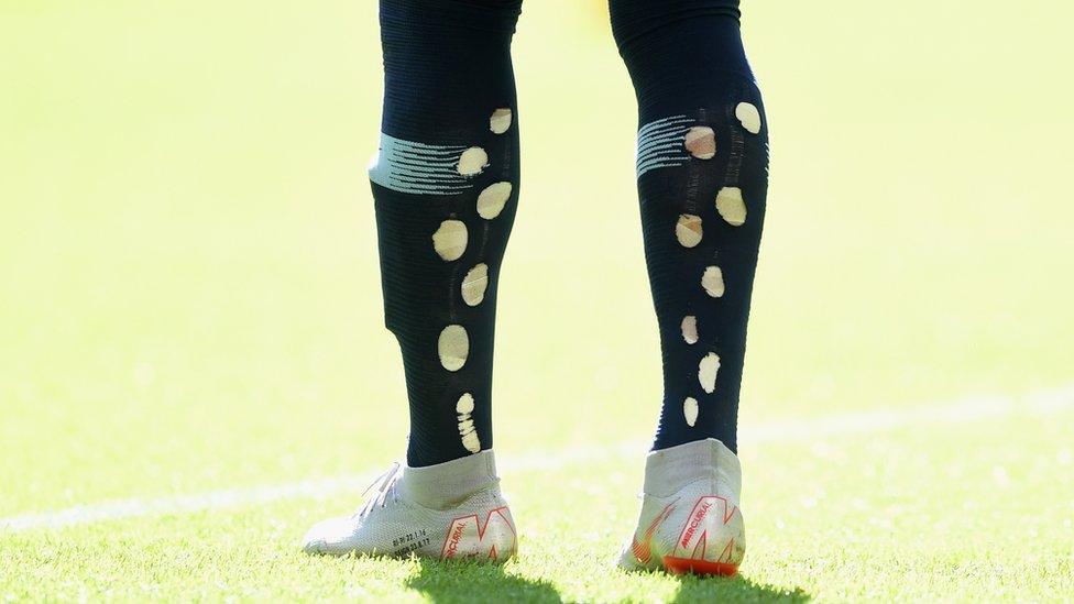 Kyle Walker's socks with holes in them