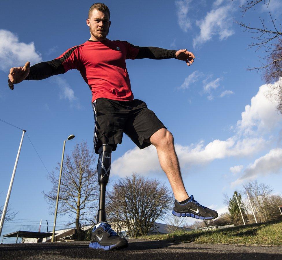 man wearing prosthetic leg