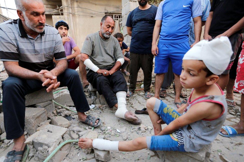 A man and his son, who were wounded by an explosion in Baghdad's Sadr City district (7 June 2018)