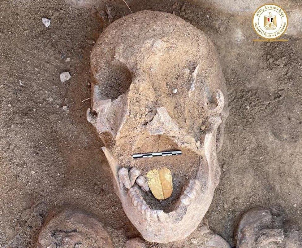 Remains of ancient Egyptian mummy with golden tongue placed inside its mouth, found at Alexandria's Taposiris Magna temple