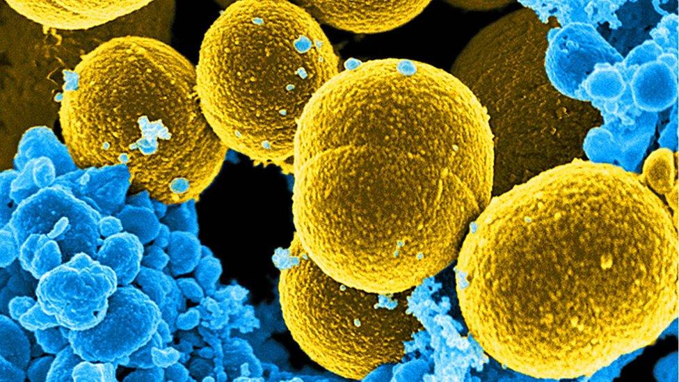 Staphylococcus aureus