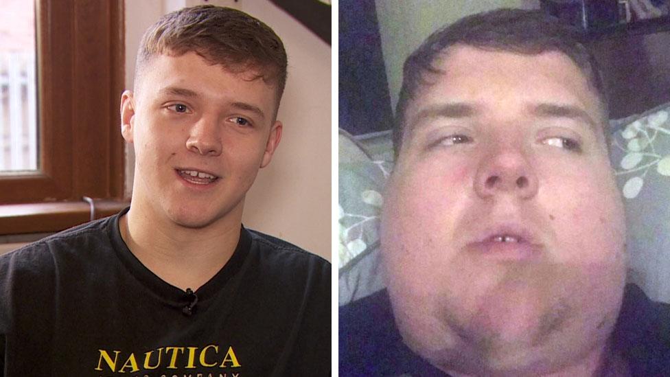 Student Olly Finch had mumps