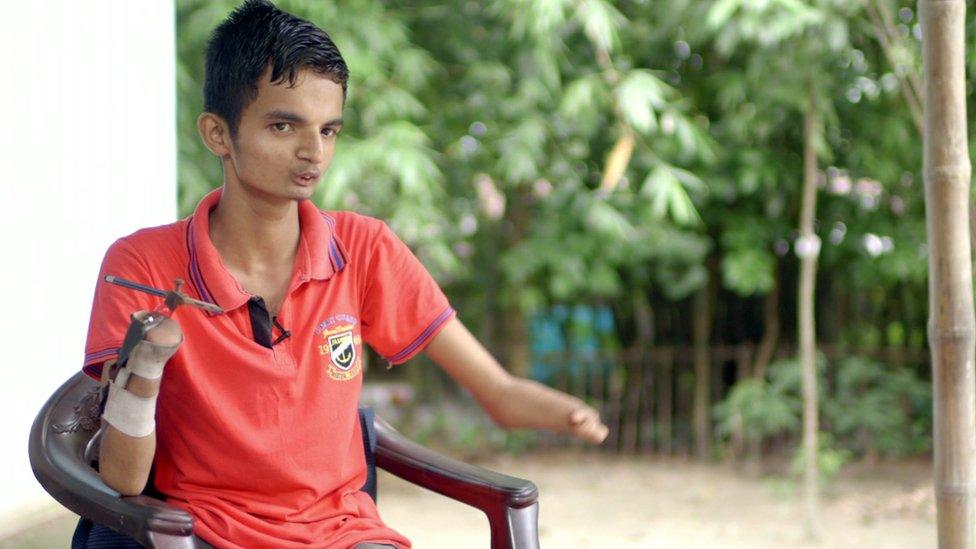 Raj Rehman sitting in a chair. His limb has a device attached to it to allow him the ability to eat