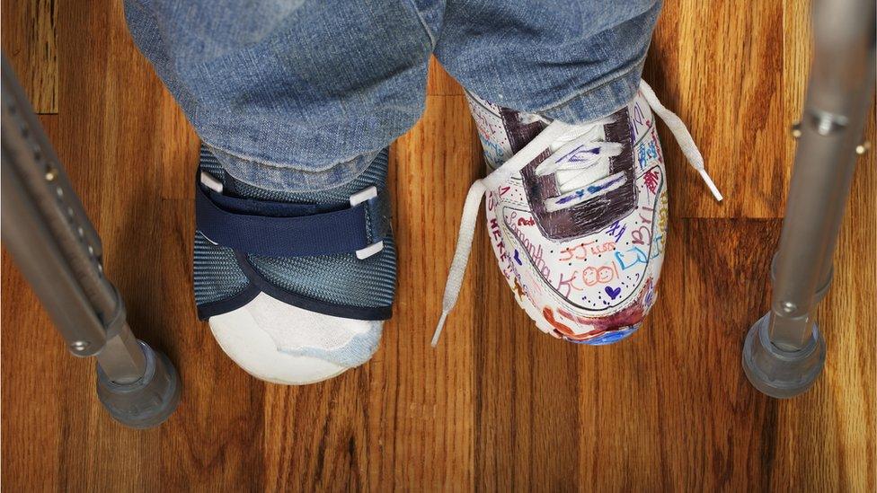 Feet of child using crutches