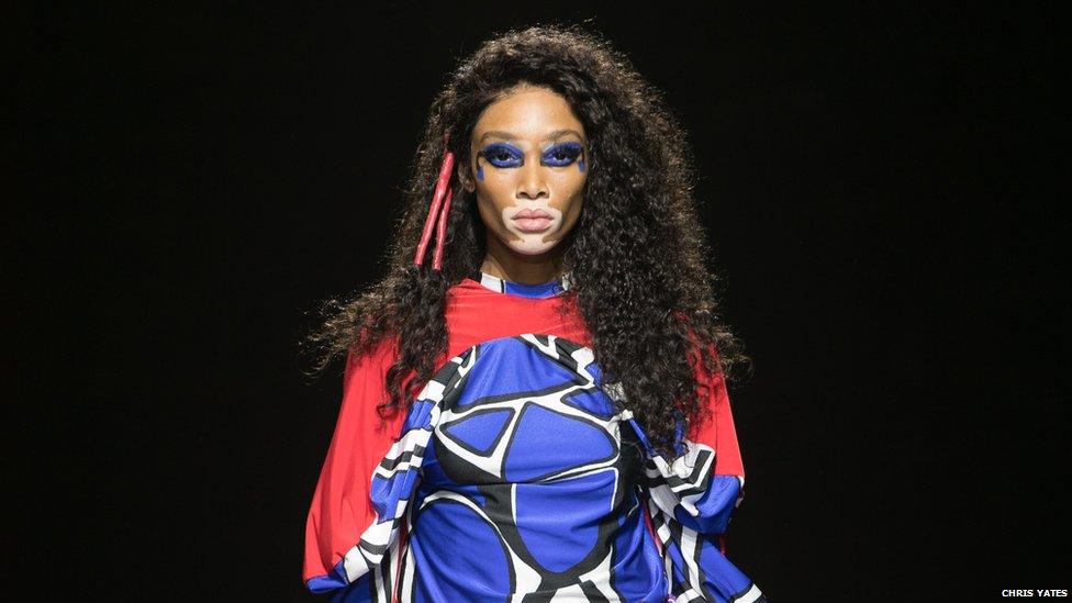 Winnie Harlow was among the famous models in Matty's show