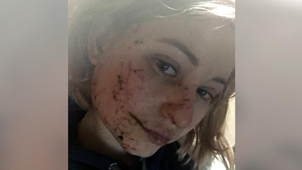 A close-up of a young woman's face with clearly visible injuries, including a cut around her mouth